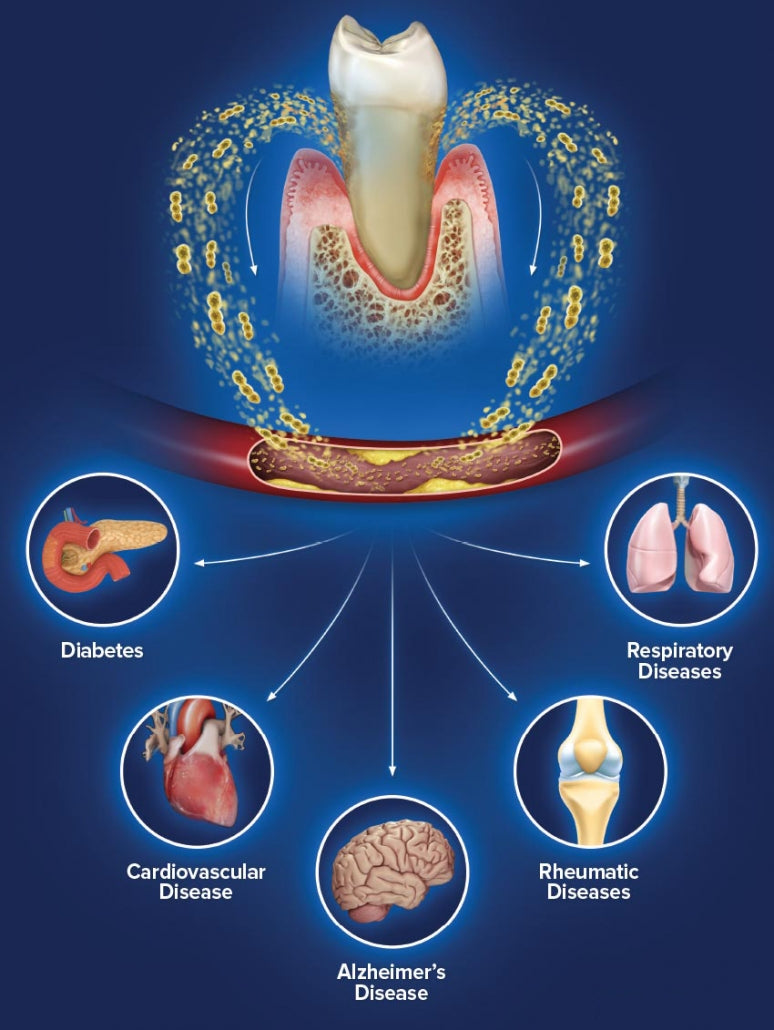 Systemic Disease